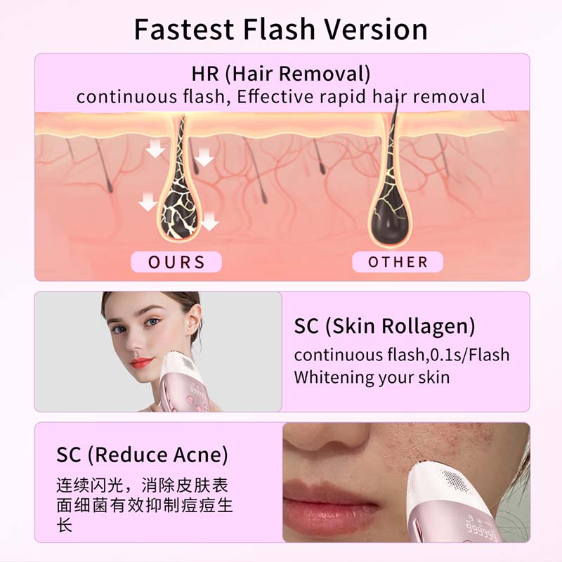 얼음 냉각 휴대용 제모기 무통증 바디 제모 가정용 충전 - Epilator Wireless 리뷰 및 가격